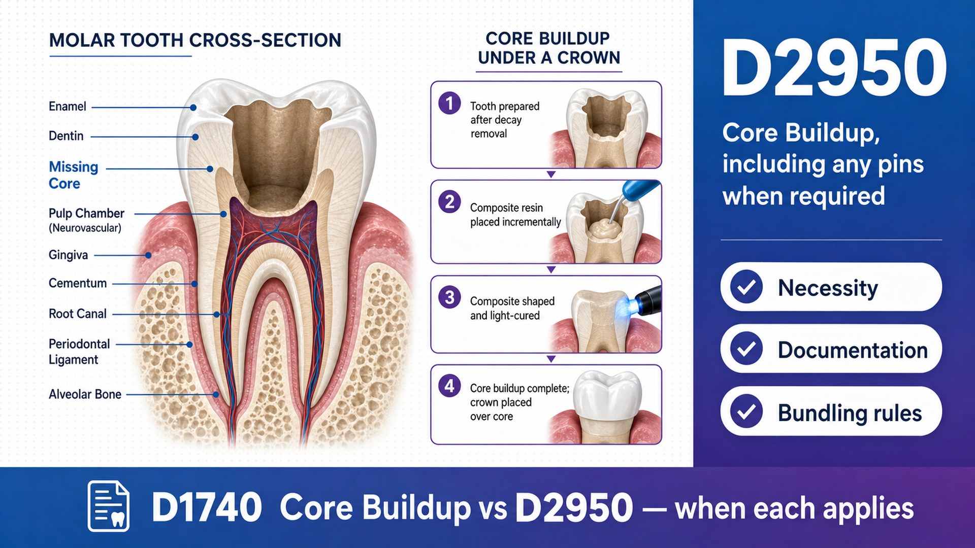 D2950 Core Buildup Billing: Documentation, Denials, and the 50% Rule (2026)